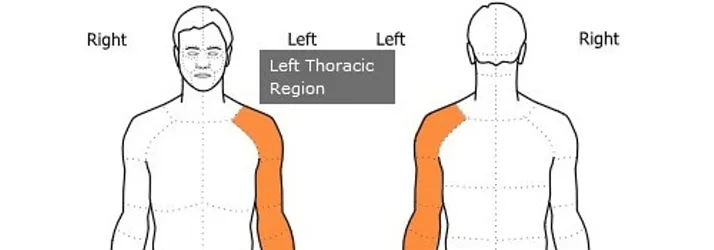 Expert Witness Gilbert AZ Diagnosis Of Cervical Spinal Cord Multiple Sclerosis