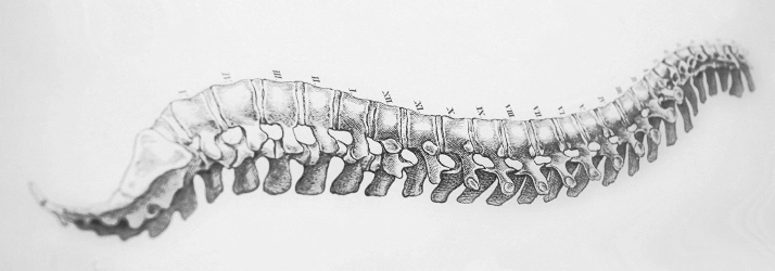 Causal Analysis Of Vertebral Artery Dissection And Fatal Stroke Following Chiropractic Cervical Spine Manipulation